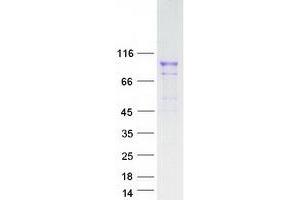 Western Blotting (WB) image for Fibroblast Growth Factor Receptor 4 (FGFR4) (Transcript Variant 2) protein (Myc-DYKDDDDK Tag) (ABIN2713673)