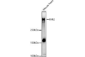 Western blot analysis of extracts of Mouse heart, using RYR2 antibody (ABIN1513493, ABIN3020906, ABIN3020907 and ABIN6213787) at 1:710 dilution. (RYR2 Antikörper  (AA 4850-4950))