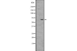Western blot analysis of BIN2 expression in HepG2 whole cell lysate ,The lane on the left is treated with the antigen-specific peptide. (BIN2 Antikörper  (Internal Region))
