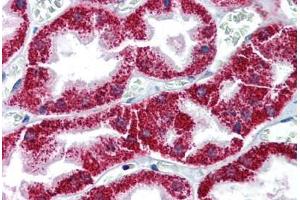 Human Kidney (formalin-fixed, paraffin-embedded) stained with BAX antibody ABIN337236 at 10 ug/ml followed by biotinylated anti-mouse IgG secondary antibody ABIN481714, alkaline phosphatase-streptavidin and chromogen. (BAX Antikörper)