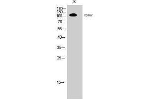 Western Blotting (WB) image for anti-EPH Receptor A7 (EPHA7) (Ser347) antibody (ABIN3178054) (EPH Receptor A7 Antikörper  (Ser347))