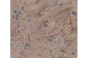 IHC-P analysis of Rat Tissue, with DAB staining. (SFRP1 Antikörper  (AA 8-153))