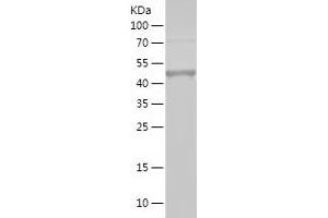 Western Blotting (WB) image for RIO Kinase 1 (RIOK1) (AA 1-131) protein (His-IF2DI Tag) (ABIN7124919) (RIOK1 Protein (AA 1-131) (His-IF2DI Tag))
