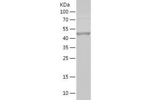 RIOK1 Protein (AA 1-131) (His-IF2DI Tag)