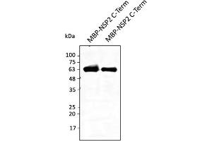 Western Blotting (WB) image for anti-SARS-CoV-2 Non-Structural Protein 2 (NSP2) (C-Term) antibody (ABIN7272997) (SARS-CoV-2 NSP2 Antikörper  (C-Term))