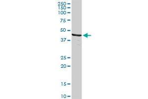 Western Blotting (WB) image for anti-DNA Fragmentation Factor, 40kDa, beta Polypeptide (Caspase-Activated DNase) (DFFB) (AA 1-338) antibody (ABIN514957)