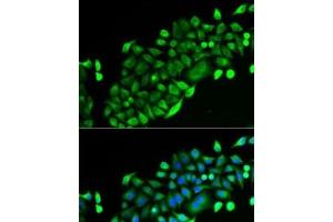 Immunofluorescence analysis of U2OS cells using GSTO2 Polyclonal Antibody (GSTO2 Antikörper)
