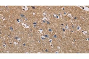Immunohistochemistry of paraffin-embedded Human brain tissue using GSTA2 Polyclonal Antibody at dilution 1:50 (GSTa2 Antikörper)
