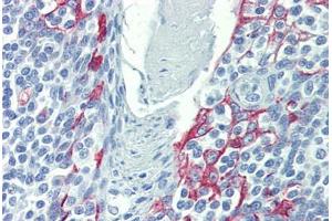 Immunohistochemistry (Formalin-fixed Paraffin-embedded Sections) (IHC (fp)) image for anti-LIM Domains Containing 1 (LIMD1) (N-Term) antibody (ABIN6744453)