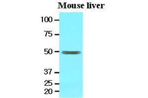 Western Blotting (WB) image for anti-Epoxide Hydrolase 1, Microsomal (Xenobiotic) (EPHX1) (AA 21-455) antibody (ABIN371868) (EPHX1 Antikörper  (AA 21-455))