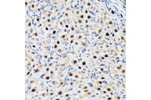 Immunohistochemistry of paraffin-embedded rat ovary using GTPBP4 Rabbit pAb (ABIN1680142, ABIN3019054, ABIN3019055 and ABIN6220689) at dilution of 1:50 (40x lens). (GTPBP4 Antikörper  (AA 385-634))