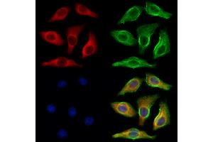 ABIN6265901 and ABIN6273084 staining Hela cells by IF/ICC.