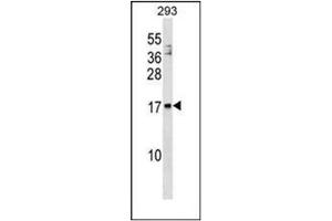 Western blot analysis of ARMET / ARP Antibody (N-term) in 293 cell line lysates (35ug/lane).
