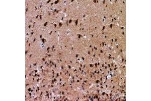 Immunohistochemical analysis of NFAT5 staining in human brain formalin fixed paraffin embedded tissue section. (NFAT5 Antikörper  (N-Term))