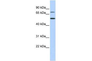 WB Suggested Anti-TBX3 Antibody Titration:  0. (TBX3 Antikörper  (Middle Region))