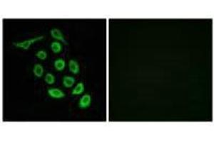 Immunofluorescence analysis of A549 cells, using RPS12 antibody. (RPS12 Antikörper  (C-Term))