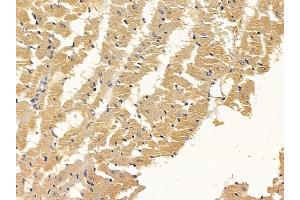 ABIN6258617 and ABIN6274962 at 1/100 staining rat heart tissue by IHC-P. (CA5B Antikörper  (C-Term))