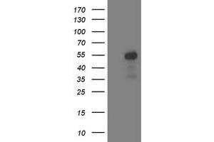 Western Blotting (WB) image for anti-Aminoacylase 1 (ACY1) antibody (ABIN1496453) (Aminoacylase 1 Antikörper)