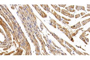 Immunohistochemistry (IHC) image for anti-Natriuretic Peptides B (NPPB) (AA 27-121) antibody (ABIN7445456)