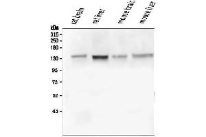 Western blot analysis of GM130 using anti-GM130 antibody (ABIN6719433). (Golgin A2 (GOLGA2) (AA 796-913) Antikörper)
