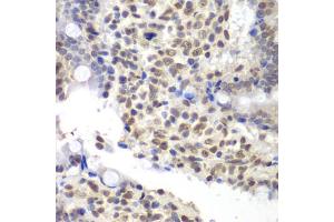 Immunohistochemistry of paraffin-embedded rat Intestine using U2AF1 antibody (ABIN5970409) at dilution of 1/200 (40x lens). (U2AF1 Antikörper)