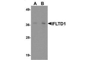 Western blot analysis of IFLTD1 in rat liver tissue lysate with IFLTD1 antibody at (A) 1 and (B) 2 ug/mL.