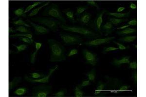 Immunofluorescence (IF) image for anti-Interleukin 15 (IL15) (AA 49-162) antibody (ABIN517140)