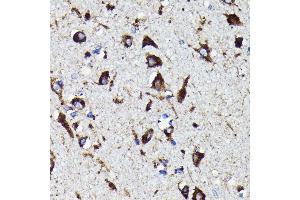 Immunohistochemistry of paraffin-embedded human brain using Cathepsin D antibody (ABIN7266149) at dilution of 1:100 (40x lens).