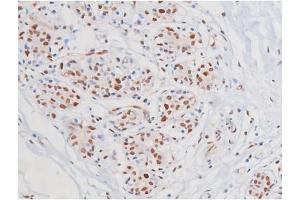 ABIN6267364 at 1/200 staining Human heart tissue sections by IHC-P.