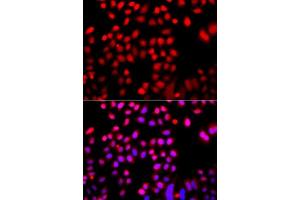 Immunofluorescence analysis of A549 cells using CFL2 antibody. (Cofilin 2 Antikörper  (AA 1-166))