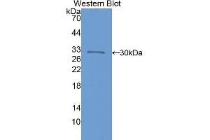 Western Blotting (WB) image for anti-Interleukin 17 Receptor C (IL17RC) (AA 73-330) antibody (ABIN1859363) (IL17RC Antikörper  (AA 73-330))