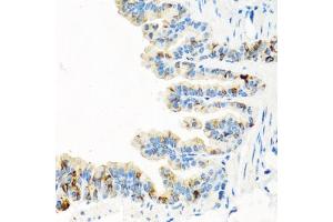 Immunohistochemistry of paraffin-embedded mouse lung using RGS5 antibody (ABIN6130676, ABIN6146924, ABIN6146925 and ABIN6222790) at dilution of 1:100 (40x lens). (RGS5 Antikörper  (AA 1-181))