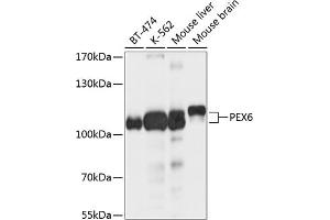Western blot analysis of extracts of various cell lines, using PEX6 antibody (ABIN6133134, ABIN6145472, ABIN6145473 and ABIN6214721) at 1:1000 dilution. (PEX6 Antikörper  (AA 741-980))