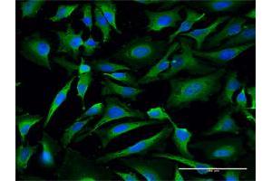 Immunofluorescence (IF) image for anti-Lactate Dehydrogenase A (LDHA) (AA 1-332) antibody (ABIN1327691)