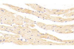 Detection of MSTN in Mouse Cardiac Muscle Tissue using Polyclonal Antibody to Myostatin (MSTN)