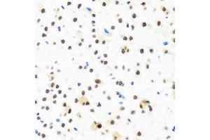 Immunohistochemistry of paraffin-embedded mouse brain using FUBP1 antibody. (FUBP1 Antikörper)