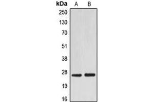 Western blot analysis of EIF4E expression in HEK293T (A), NIH3T3 (B) whole cell lysates. (EIF4E Antikörper  (C-Term))