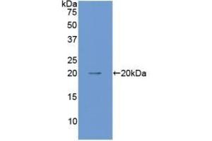 Detection of Recombinant ANGPT1, Mouse using Polyclonal Antibody to Angiopoietin 1 (ANGPT1) (Angiopoietin 1 Antikörper  (AA 253-429))
