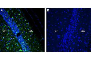 Expression of TREM2 in mouse hippocampus in a kainic acid neurodegeneration model.