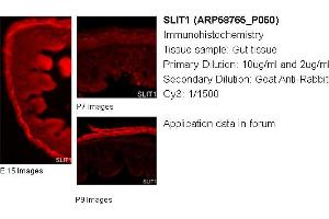 Image no. 1 for anti-Slit Homolog 1 (SLIT1) (Middle Region) antibody (ABIN2774236) (SLIT1 Antikörper  (Middle Region))