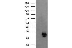 Image no. 1 for anti-NFKB Inhibitor Interacting Ras-Like 1 (NKIRAS1) antibody (ABIN1499742) (NKIRAS1 Antikörper)