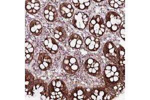 Immunohistochemical staining of human colon with PHLDB1 polyclonal antibody  shows strong cytoplasmic positivity in glandular cells. (PHLDB1 Antikörper)