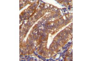 POSTN Antibody immunohistochemistry analysis in formalin fixed and paraffin embedded human uterus tissue followed by peroxidase conjugation of the secondary antibody and DAB staining. (Periostin Antikörper  (C-Term))