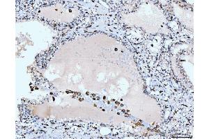IHC analysis of CD163 using anti-CD163 antibody (ABIN5693082). (CD163 Antikörper  (AA 47-201))