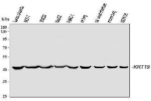Western blot analysis of Cytokeratin 19 using anti-Cytokeratin 19 antibody (ABIN3043288).