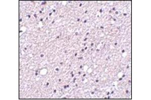 Immunohistochemistry of NK3R in human brain tissue with this product at 5 μg/ml. (TACR3 Antikörper  (Center))