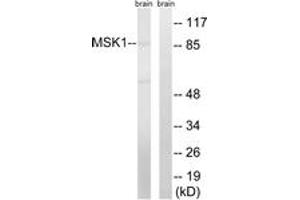 Western blot analysis of extracts from mouse brain cells, using MSK1 (Ab-212) Antibody. (MSK1 Antikörper  (AA 181-230))