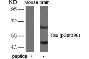 Western blot analysis of extracts from mouse brain tissue using Tau(Phospho-Ser396) Antibody and the same antibody preincubated with blocking peptide. (MAPT Antikörper  (pSer396))