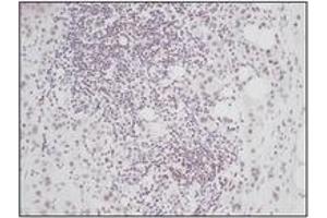 Image no. 1 for anti-Connective Tissue Growth Factor (CTGF) antibody (ABIN181700) (CTGF Antikörper)