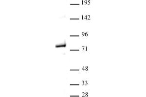 Western blot of Menin antibody. (Menin Antikörper  (C-Term))